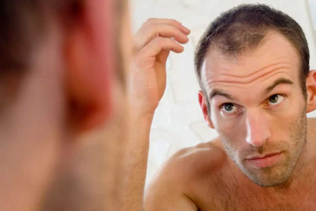 Rambut Kamu Tipis? Terapkan 4 Tips Mudah Ini
