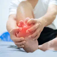 Ilustrasi sakit asam urat. (Shutterstock)