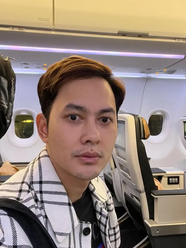 7 Potret Kiki Farel Transplantasi Rambut, Seru Nikmati Liburan Sebelum Operasi