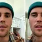 Justin Bieber alami Ramsay Hunt Syndrome yang membuat saraf wajah lumpuh sebelah. (Foto: Potongan layar Instagram @justinbieber)