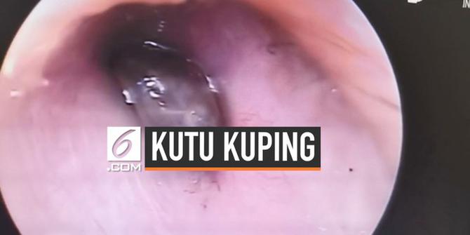 VIDEO: Detik-Detik Kutu Penghisap Darah Diambil dari Kuping