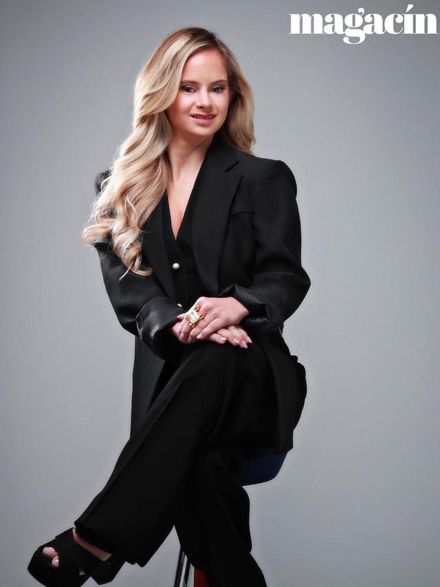 6 Potret Sofia Jirau, Model Down Syndrome Pertama Victoria's Secret