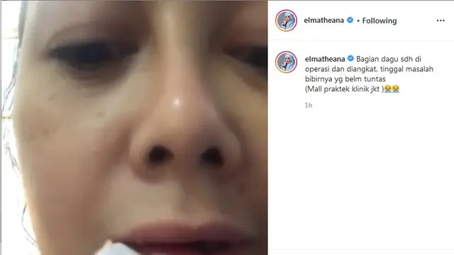 Rency Milano, kakak Elma Theana (Foto: Instagram/@elmatheana)