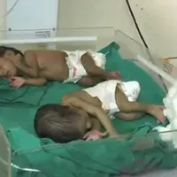 Dua bayi malang terlihat di salah satu rumah sakit di Gwalior, Madhya Pradesh, India. (Ruptly)