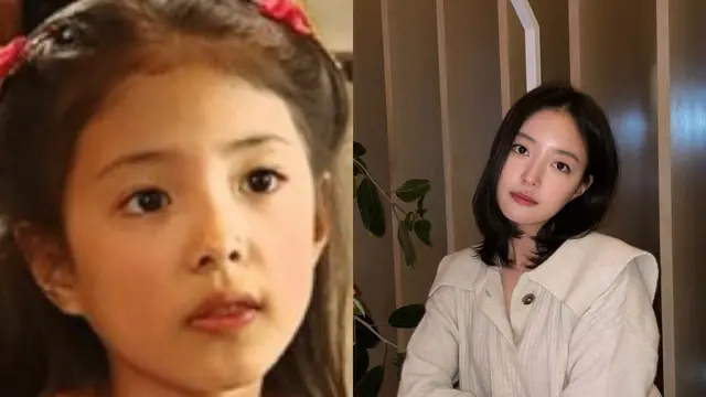 Lee Se Young kecil (Dok. Allkpop) dan Lee Se Young (Instagram/seyoung_10)