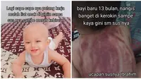 Viral Ibu Curhat Anaknya Berusia 13 Bulan Dikerok. (Sumber: TikTok/@tia.rochman)