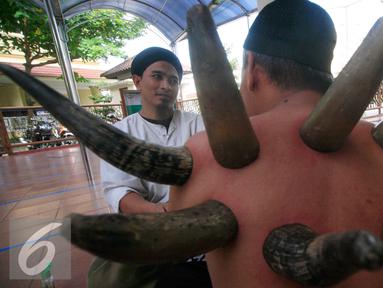 Seorang pasien menjalani pengobatan bekam tanduk di Masjid Malioboro, Yogyakarta, Minggu (17/4). Bekam dengan menggunakan tanduk binatang ini sangat digemari pasien. (Liputan6.com/Boy Harjanto)