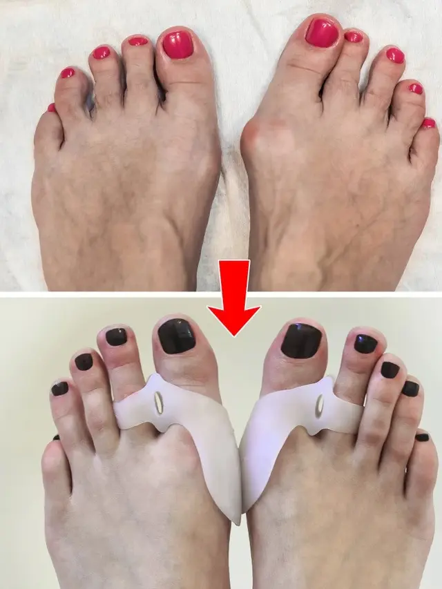 Tips Perawatan Kaki