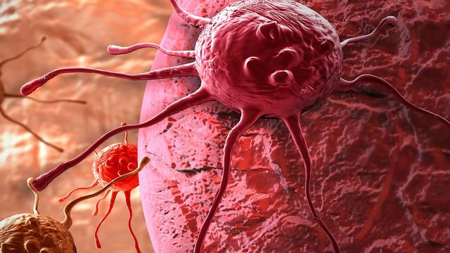 [Bintang] Menemukan Benjolan di Payudara? Ini yang Harus Kamu Lakukan