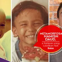 Metamorfosa Hamish Daud, si Tampan yang Luluhkan Hati Raisa. (Foto: Instagram/hamishdw dan Nurwahyunan, Desain: Nurman Abdul Hakim/Bintang.com)