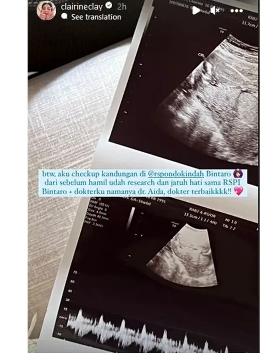 Kebahagiaan Joshua dan Clairine Clay umumkan kehamilan pertama. (Sumber: Instagram/clairineclay)