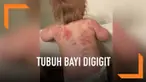 Seorang ibu asal Arizona, Amerika Serikat terkejut bukan main menemukan banyak bekas gigitan di tubuh buah hatinya. Bekas gigitan ditemukan usai bayinya yang berusia 15 bulan itu dititipkan di tempat penitipan anak.