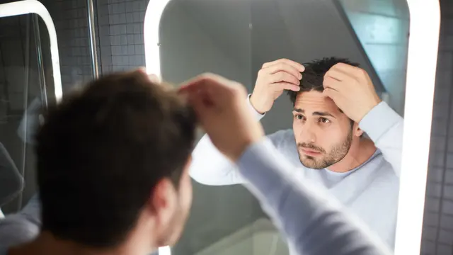 Kebotakan Rambut Pada Pria, Ternyata Ini Penyebab dan Cara Mengatasinya