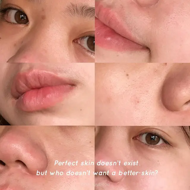 #ShowYourPores, Ubah Standar Kecantikan Usir Insecurity Pada Perempuan