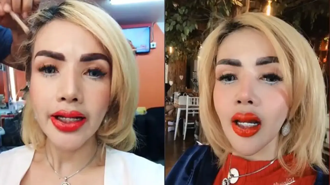 7 Potret Penampilan Terbaru Barbie Kumalasari Usai Sulam Bibir, Bengkak dan Merah