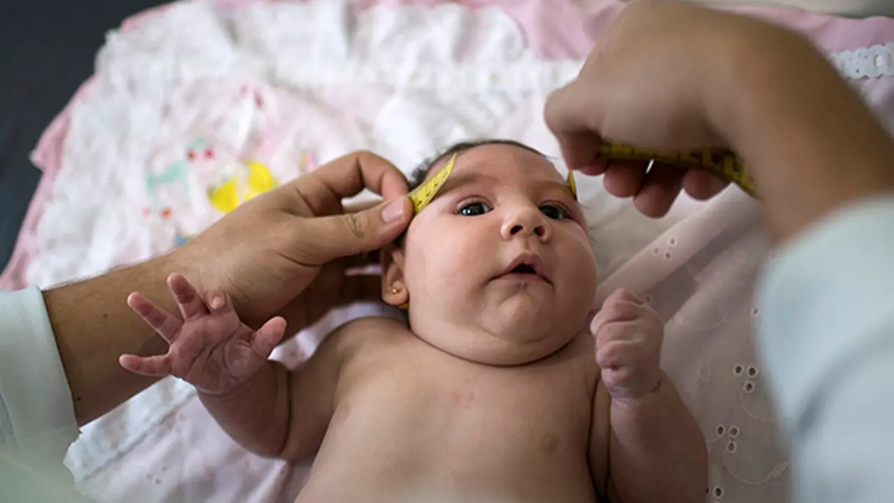 Virus Zika