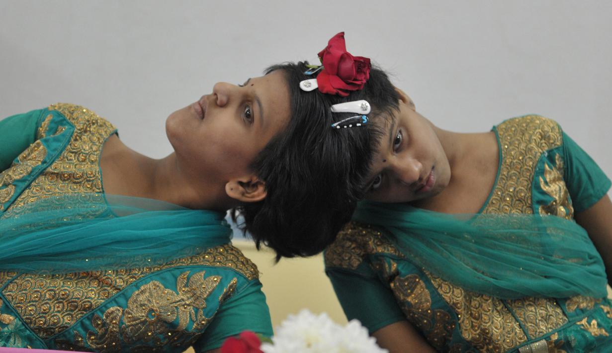 Veena (kanan) dan Vani saat berada di Rumah Anak di Hyderabad, India (2/1). Mereka telah dipindahkan dari fasilitas perawatan ke lingkungan masyarakat supaya dapat meningkatkan pembangunan pendidikan dan sosial mereka. (AFP/Noah Seelam)