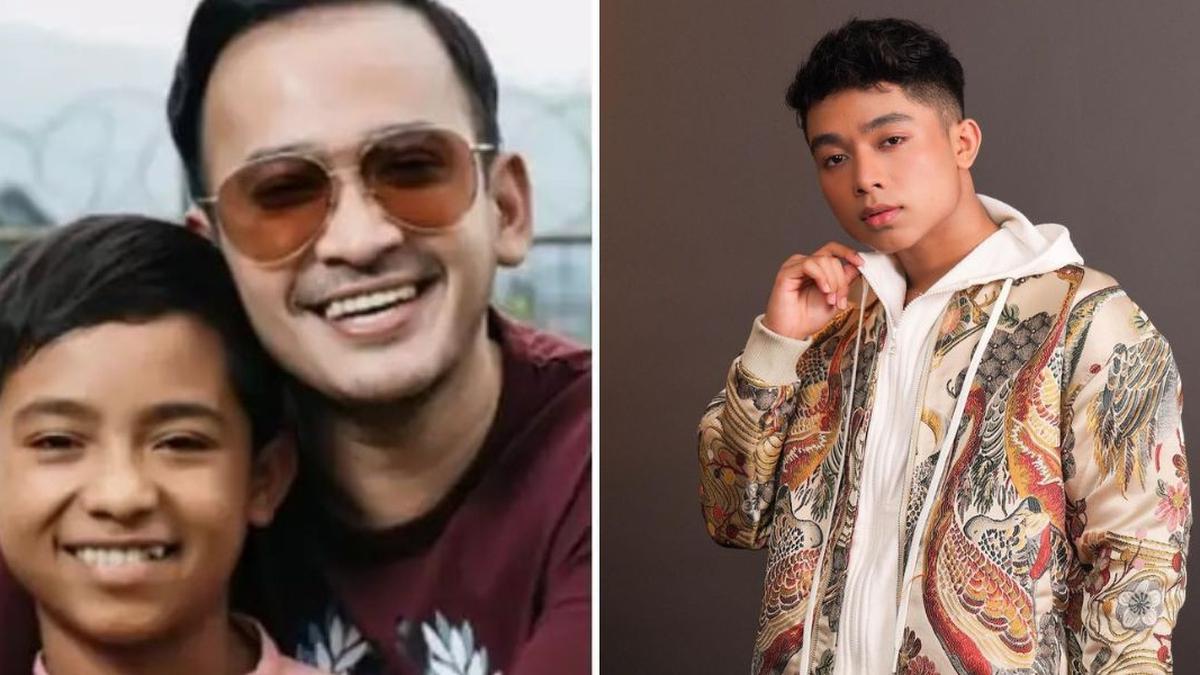 Transformasi Bertrand Peto dari Dulu Hingga Kini, Makin Glowing Berkat Perawatan
