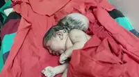Kondisi Langka, Bayi Lahir dengan Tiga Kepala Bikin Geger