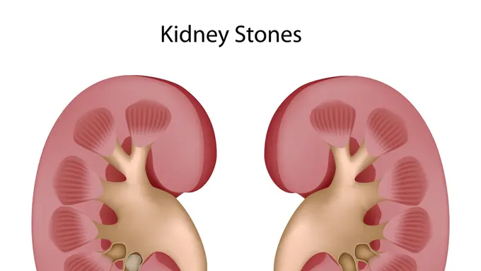 3 Makanan yang Bikin Ginjal Sehat Selalu 