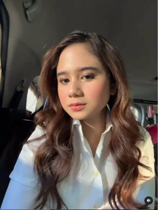 6 Potret Tissa Biani 4 tahun jadi pejuang jerawat, kerap nangis saat bercermin, ajarkan kesabaran