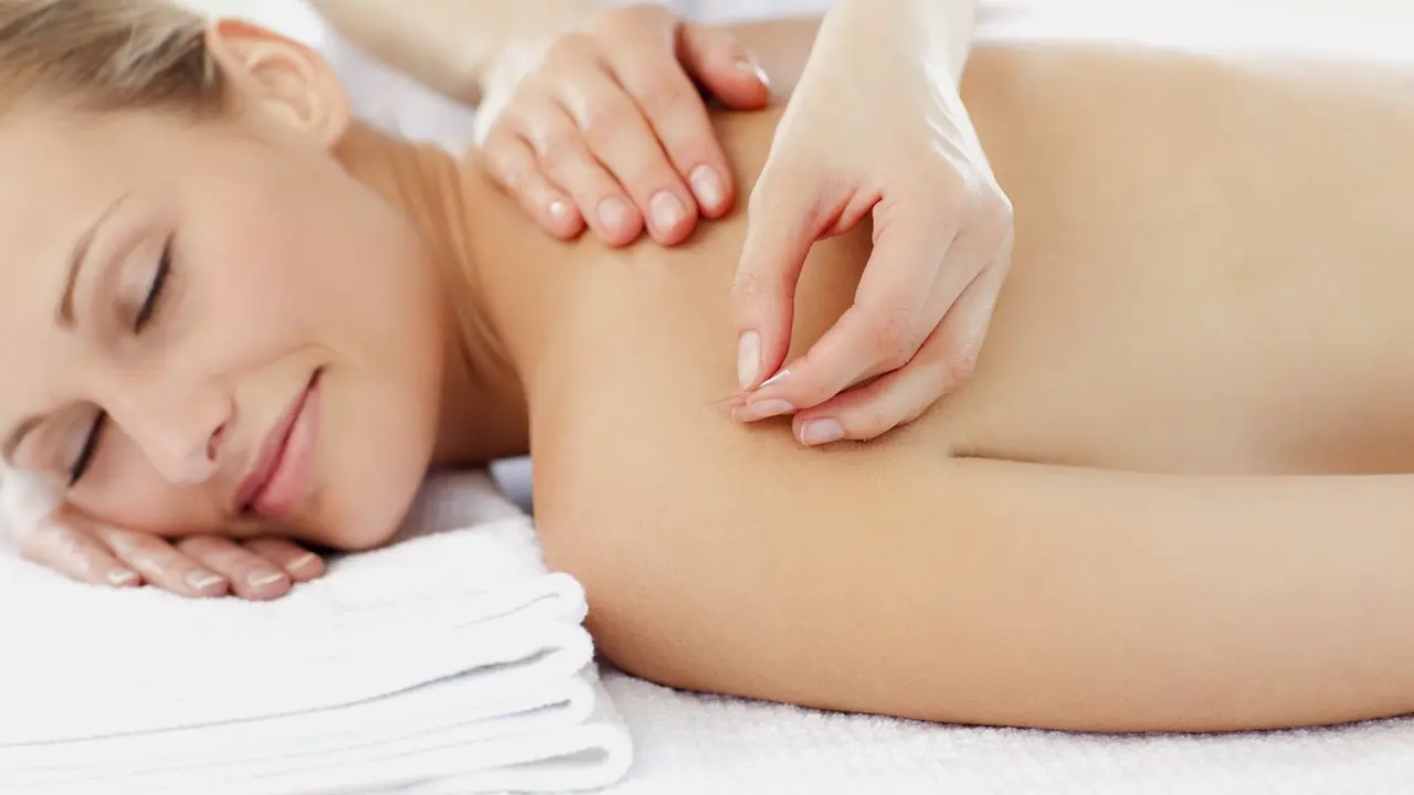 Akupunktur di Titik Ini Jadi Favorit Para Wanita