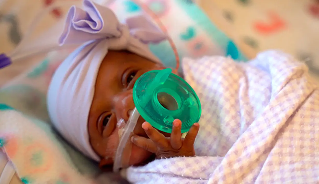 Foto pada Maret 2019 memperlihatkan seorang bayi yang dipanggil dengan nama Saybie. Setelah hampir lima bulan di unit perawatan intensif neonatal, Saybie pulang ke rumahnya di awal bulan Mei dan beratnya kini sudah berada di angka 2,2 kilogram. (Sharp HealthCare via AP)