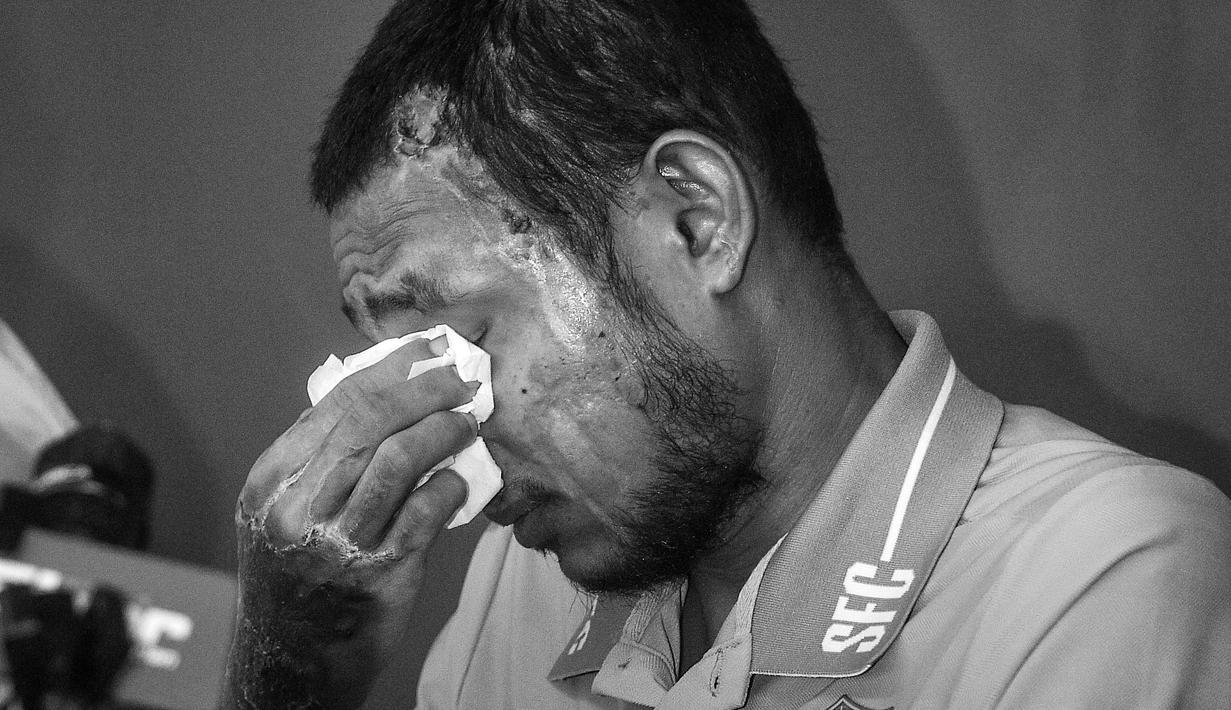 Pemain Malaysia, Faisal Halim menyeka matanya saat jumpa pers pemusatan latihan Selangor FC di Padang SUK Shah Alam, Kamis (13/6/2024). Terlihat luka bakar di sejumlah bagian tubuhnya akibat insiden penyiraman air keras oleh orang yang tak dikenal pada 5 Mei 2024. (AFP/Arif Kartono)