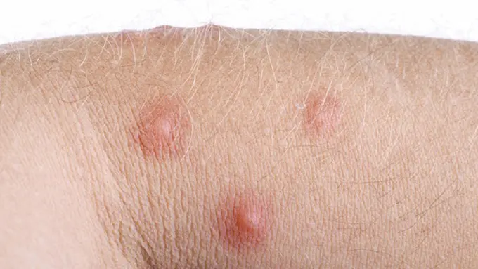 Foto: copyright thinkstockphotos.com