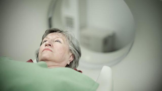 Pengobatan Tumor Otak