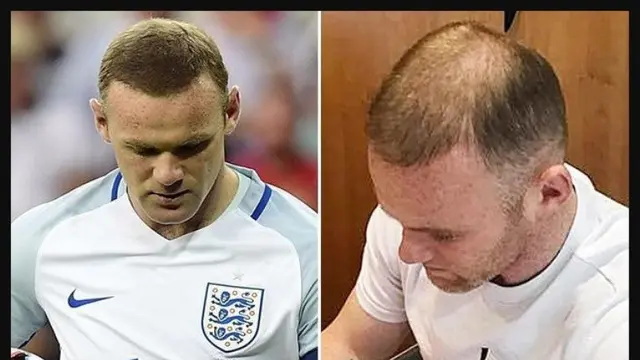 Wayne Rooney