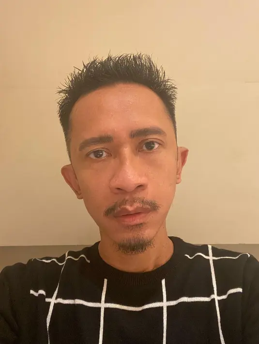 Tidak hanya sekedar memotong rambut pendek, tapi juga pakai model pomade. "Sok2an pake pomade lagi🥲 Jujur tadinya kurang PD…tp mayan jg y ternyata dengan dahi nongnongnya ini," lanjut Aming. [Instagram/amingisback]
