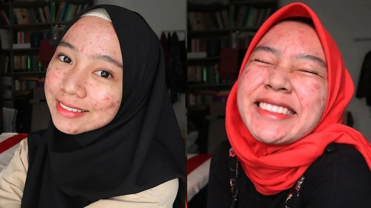Percaya Diri Unggah Foto Berjawat di Medsos, Perempuan Ini Viral dan Menginspirasi