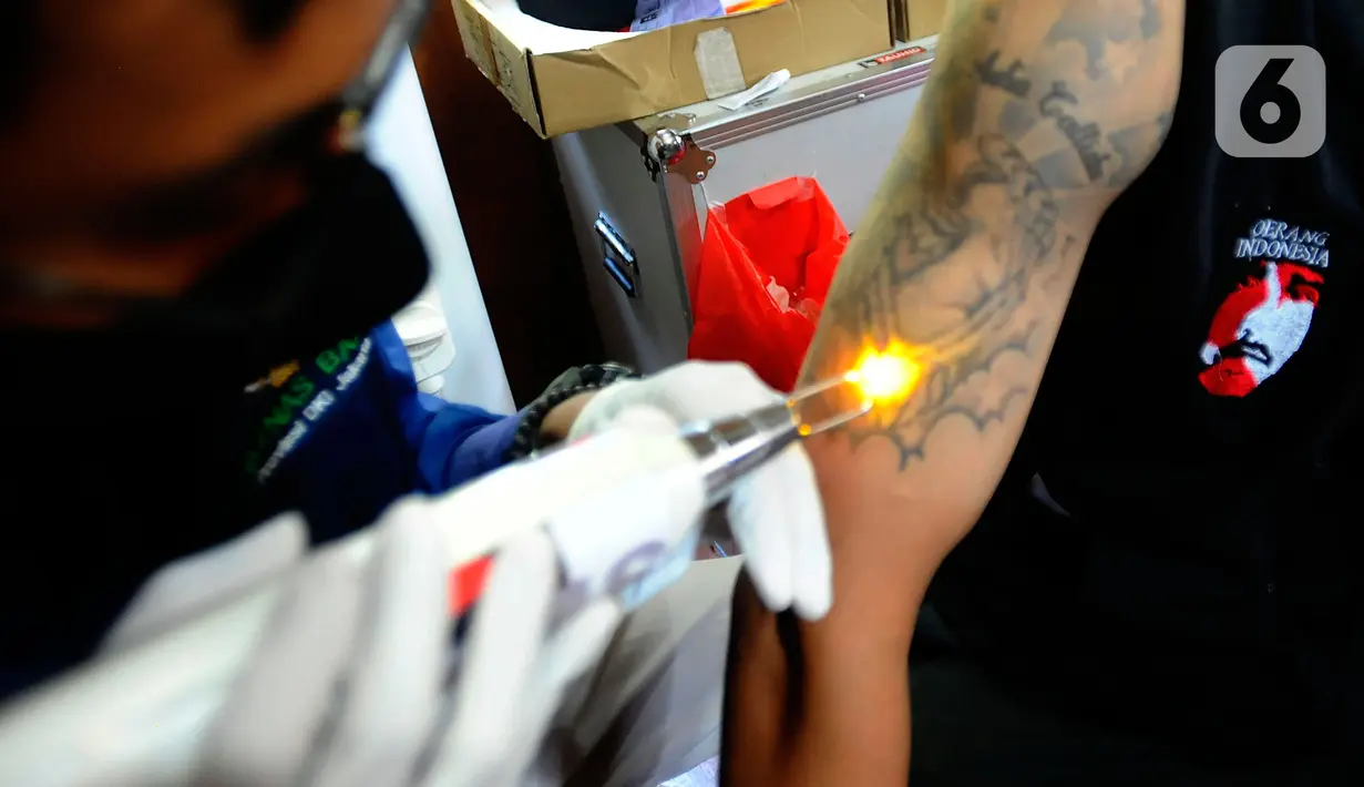 Warga saat mengikuti kegiataan hapus tato gratis saat pelaksanaan Festival Budaya Setu Babakan di Setu babakan, jakarta selatan, Minggu (14/08/20222). Lebih dari seratus warga dihapus tatonya dalam kegiatan yang diselenggarakan oleh IMS (Islamic Medical Service), KADIN Jaksel dan Baznas (Bazis) ini. (merdeka.com/Arie Basuki)
