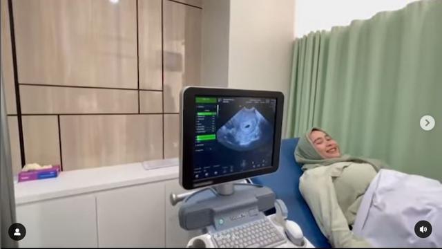 Setahun Melahirkan, Ini 6 Potret Syifa Adik Ayu Ting Ting Hamil Anak Kedua