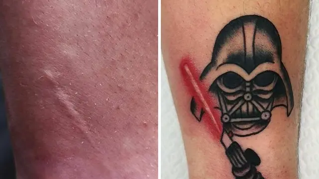 Gunakan Tato Untuk Menutupi Bekas Luka, 6 Potret Hasilnya Bikin Takjub. (Sumber: Boredpanda)
