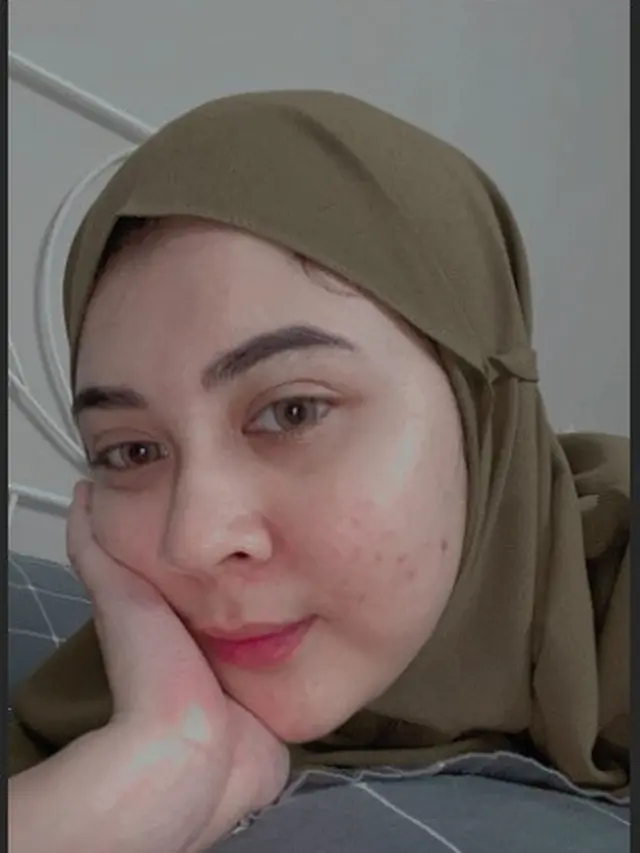 Dibully karena Jerawat, Ini 6 Potret Kesha Ratuliu Tanpa Makeup