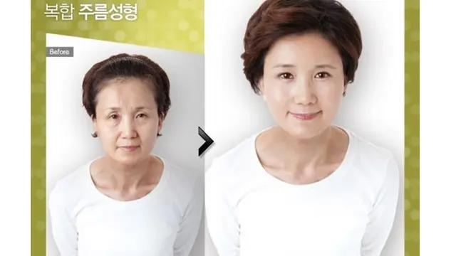 (c) kpsurgery tumblr.com