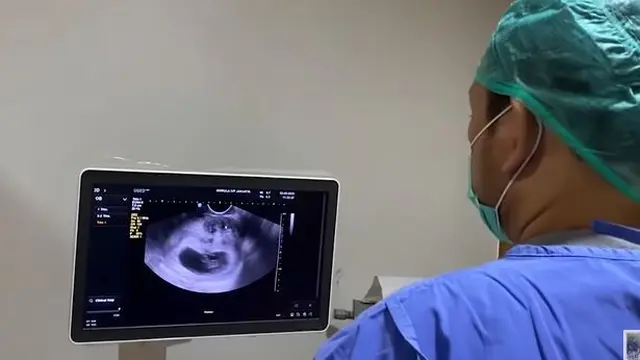 Mulai Rasakan Mual, Ini 6 Momen Zaskia Sungkar Cek USG Pertama Kali