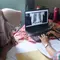 Kontak Erat Pasien TB Dapat Terapi Pencegahan, Ini Alasannya