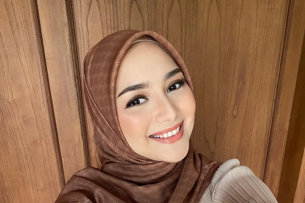 Kembaran Sama Rezky Adhitya, Ini 6 Potret Citra Kirana yang Kini Pasang Behel