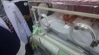 Bayi lahir tanpa tempurung kepala di Bogor (Achmad Sudarno/Liputan6.com)
