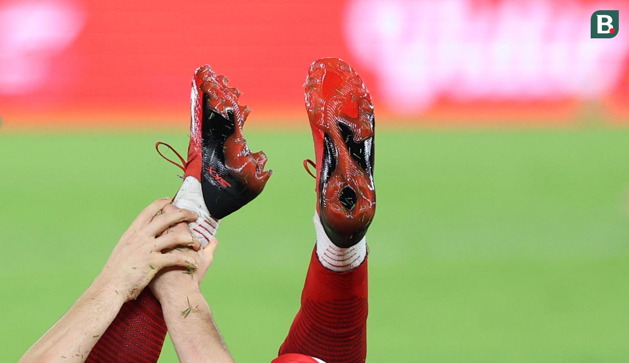 Cedera itu dialami Zijlstra ketika membela Timnas Indonesia menghadapi Timnas Saint Kitts dan Nevis dalam partai pertama FIFA Series 2026 di Stadion Utama Gelora Bung Karno (SUGBK), Jakarta Pusat, pada 27 Maret 2025. (Bola.com/M Iqbal Ichsan)