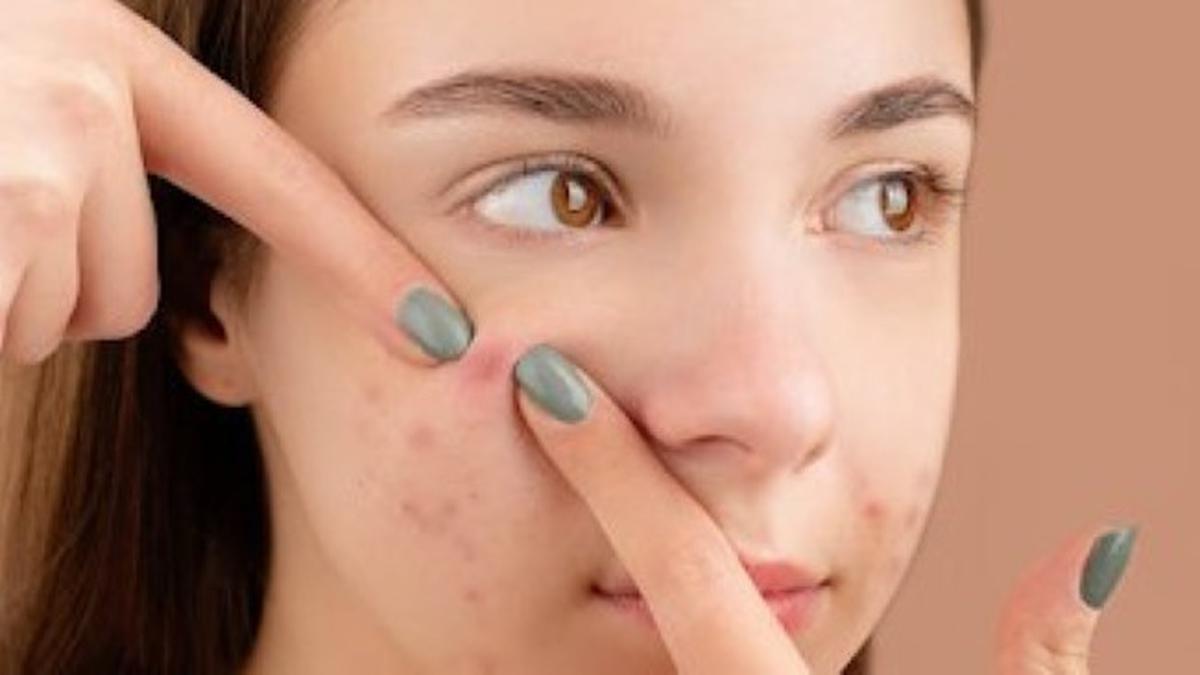 4 Tips Memilih Skincare yang Cocok untuk Kulit Sensitif