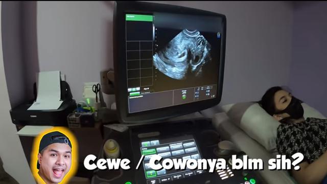 Bayinya Sehat, Ini 6 Momen Chelsea Olivia Periksa Kandungan