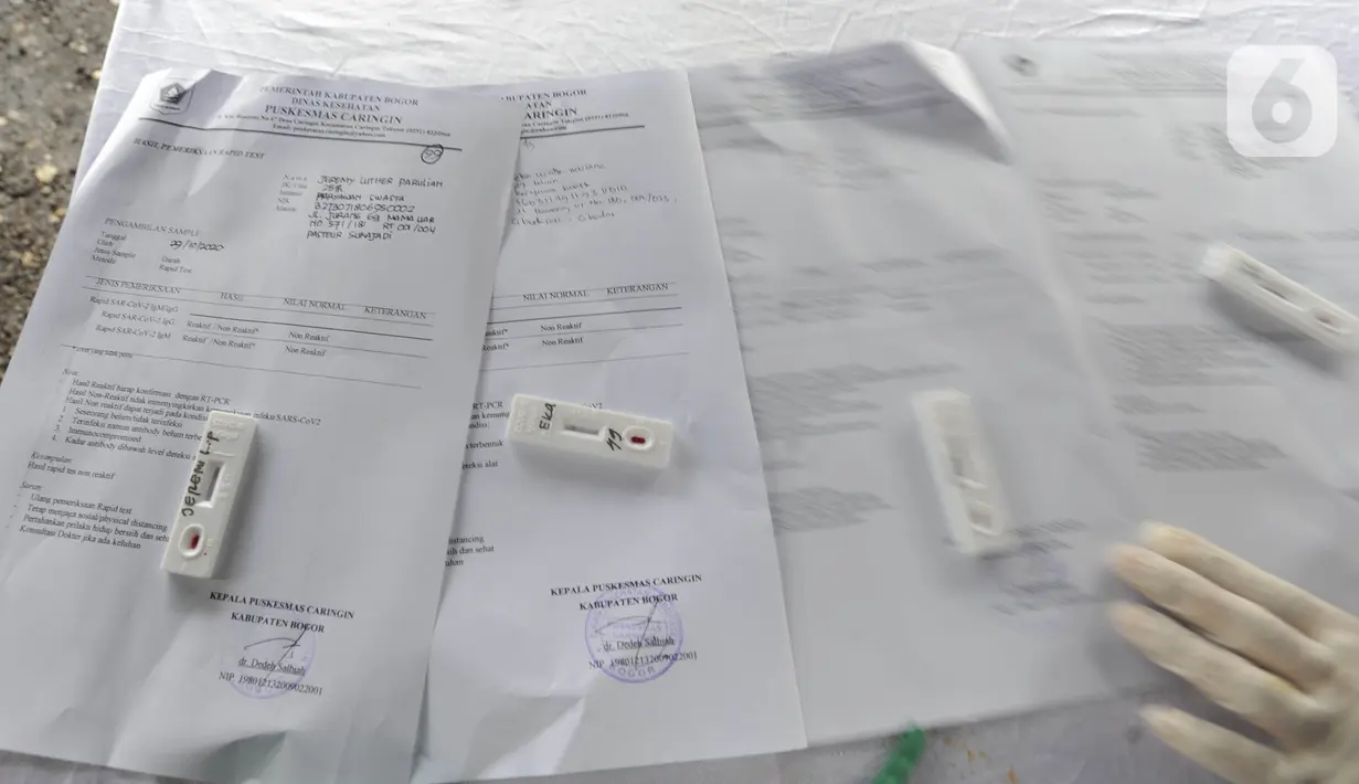 Hasil rapid test wisatawan di kawasan Gadog, Bogor, Jawa Barat, Kamis (29/10/2020. Pemkab Bogor mewajibkan wisatawan yang mengunjungi kawasan Puncak dan sekitarnya untuk mengikuti rapid test untuk mencegah penyebaran COVID-19. (merdeka.com/Arie Basuki)