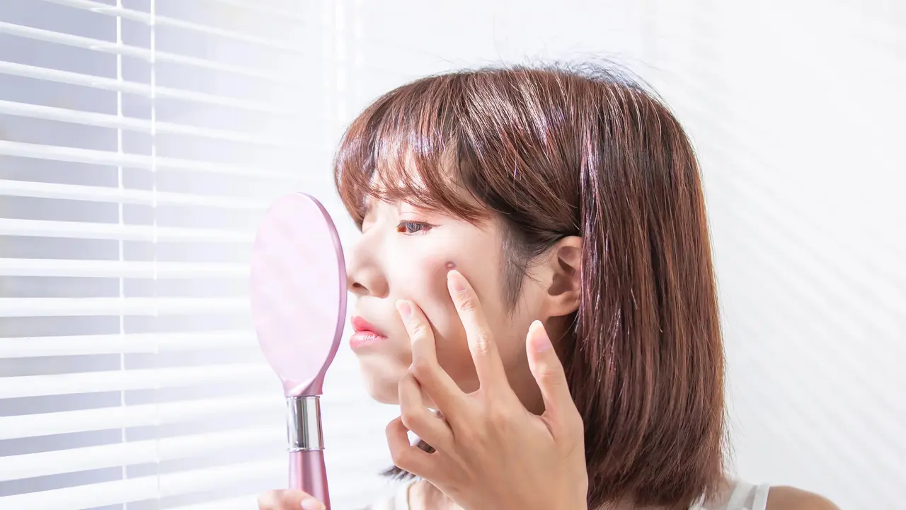 Mau Menggunakan Makeup Saat Wajah Jerawatan? Begini Triknya Biar Kondisinya Nggak Semakin Meradang