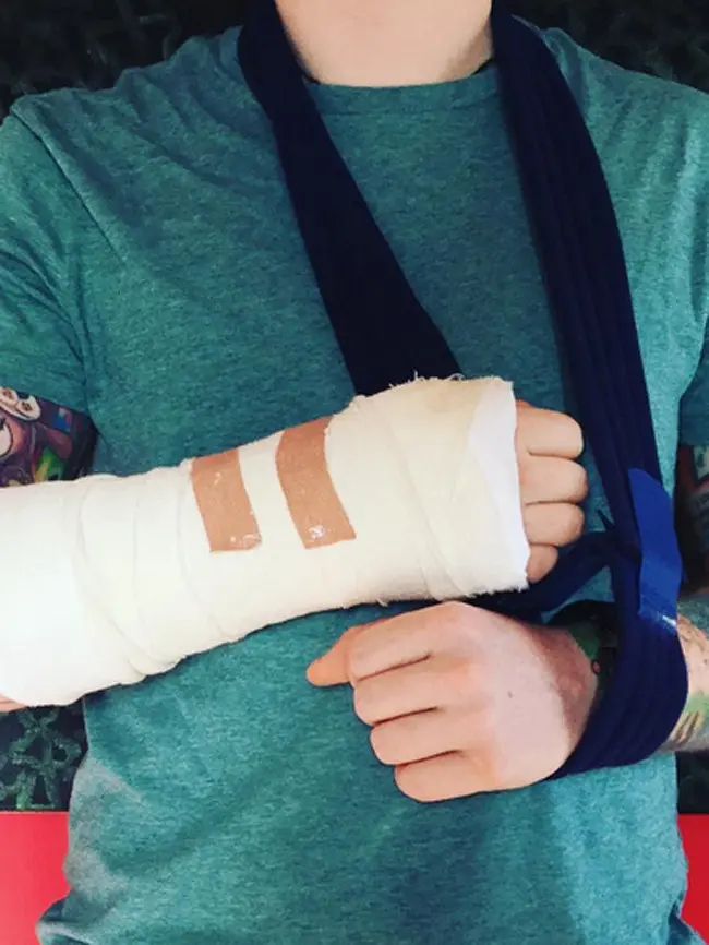 “Aku mengalami kecelakaan saat bersepeda. Aku sedang menjalani perawatan khusus  lantaran mengalami  patah tulang di bagian tanganku,” tulis Ed Sheeran. (Instagram/teddysphotos)