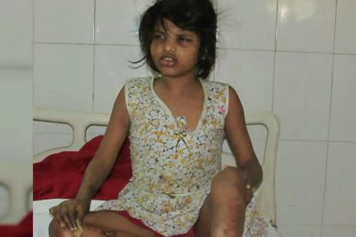 Bocah Mowgli dari India. (Times of India)