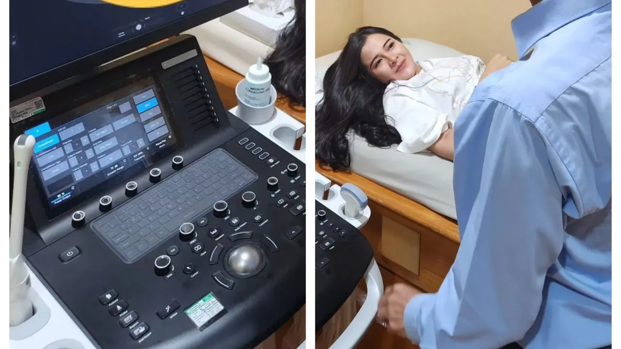 Istri Denny Caknan Umumkan Hamil Anak Pertama